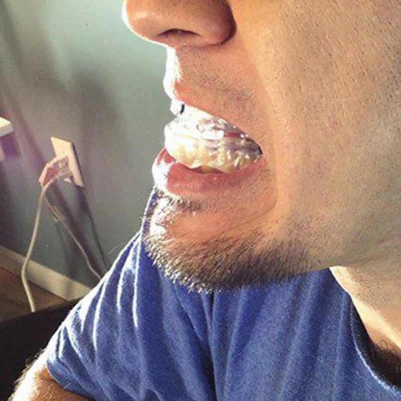 Anti Snoring Mouth guard